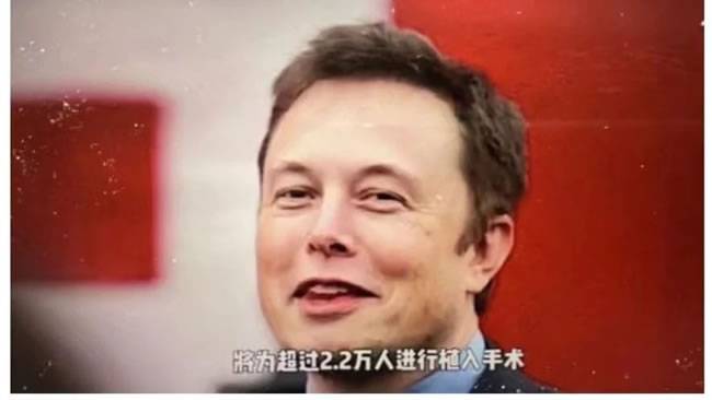 马斯克说，2030年将有2.2万人植入人脑芯片